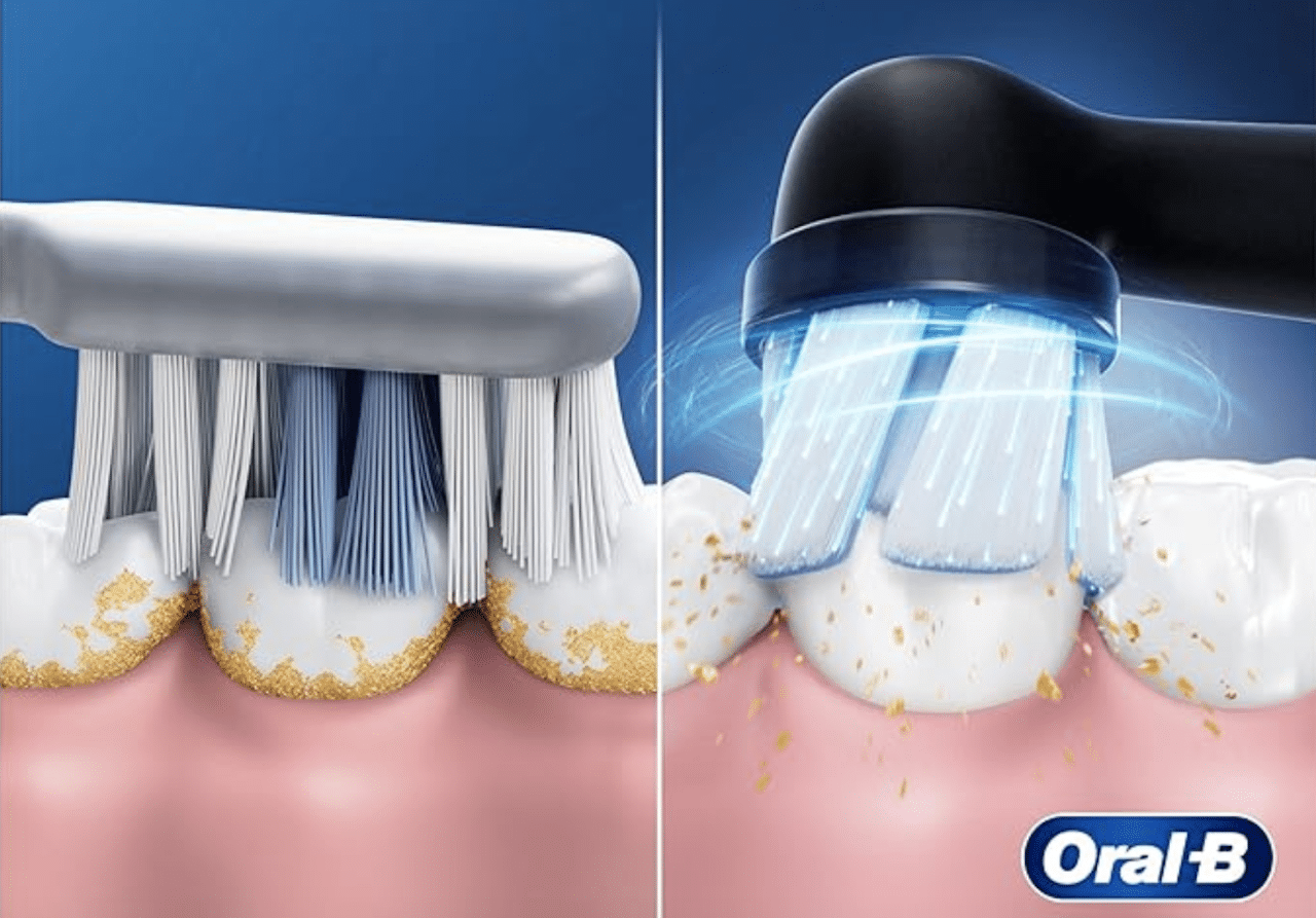 Un schéma comparatif de l'état des dents et gencives, à gauche avec une brosse à dent manuelle, et à droite avec une brosse à dent électrique de la marque Oral-B.